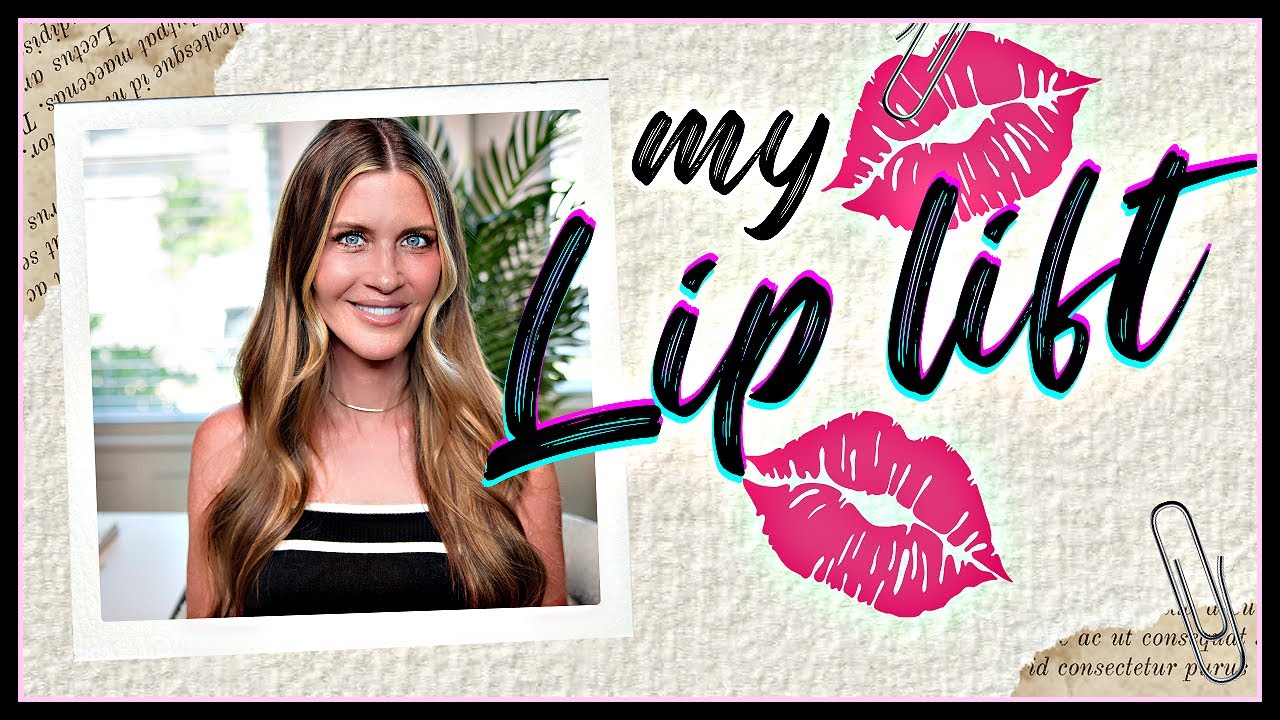 LIP LIFTS: What I Learned from Dr. Kim + MY lip lift experience 🩵