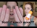 DOES IT REALLY WORK?? Body Shop Vitamin C Peel