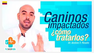 Caninos Impactados Tu Salud Guía