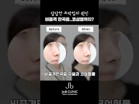 유튜브 영상 썸네일
