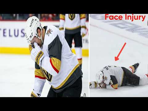 Video Brayden McNabb Fast to Hospital After Devastating 87 MPH Shot to the Face | Stanley Cup Final Game