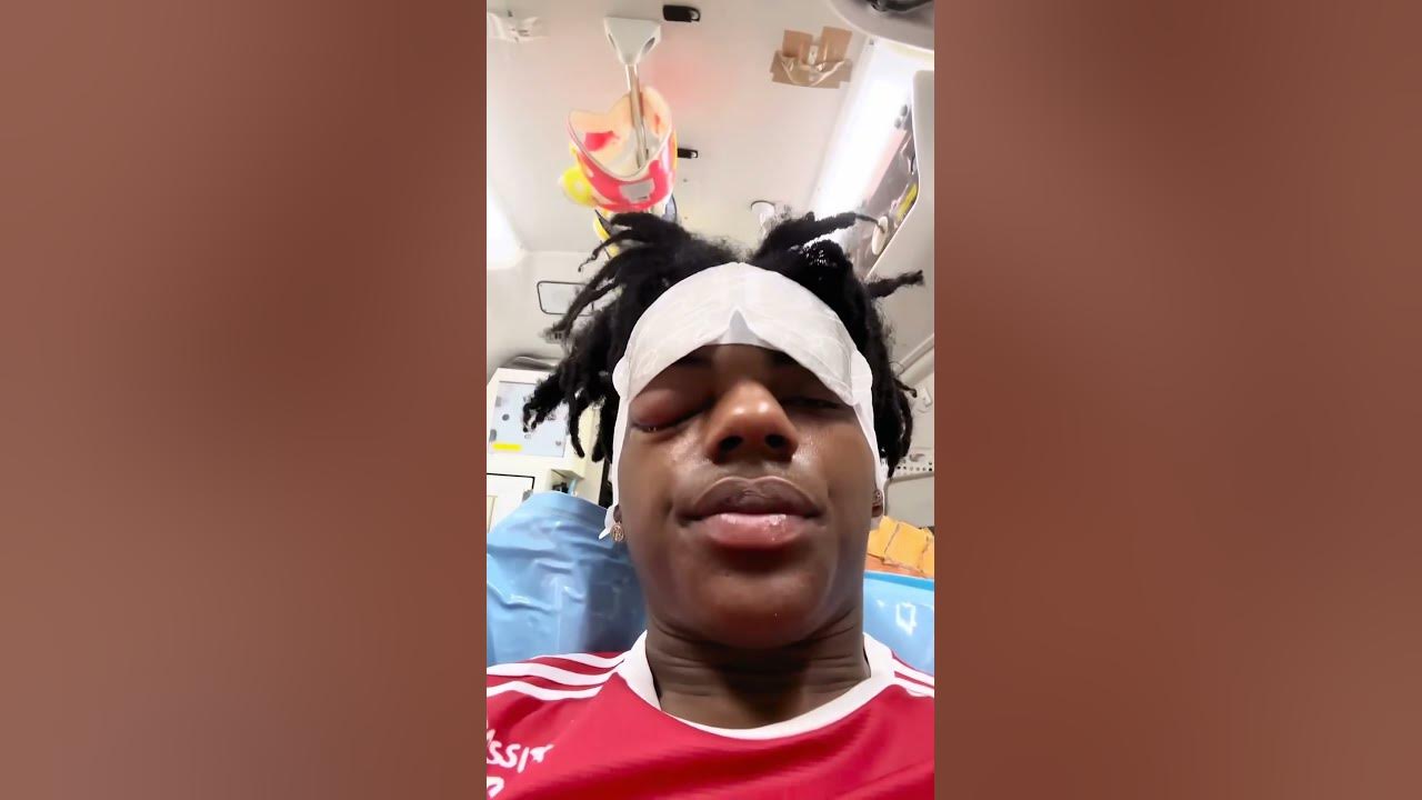 Ishowspeed eye Injury 🤕#shorts - YouTube