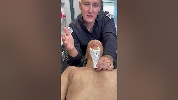 Landmarking for a Cricothyrotomy