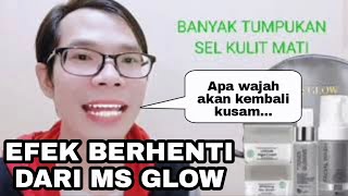 5 Efek Berhenti Dari Skincare Ms Glow!!!