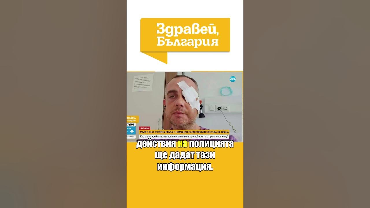 Счупена скула и комоцио след побой: Мъж твърди, че банда напада хора ...