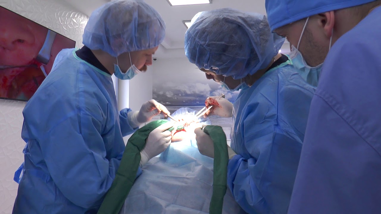 PRACTICULUM IMPLANTOLOGII SEZON VB SESJA 7 ZABIEG 5
