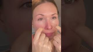 Smile laugh lines removal acupuncture massage technique