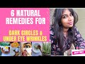 Treat Under Eye Wrinkles, Dark Circles,Puffiness with ONLY Natural Remedies| DIY Affordable Skincare