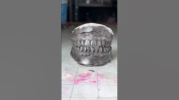 Cold Casting Teeth with Iron
