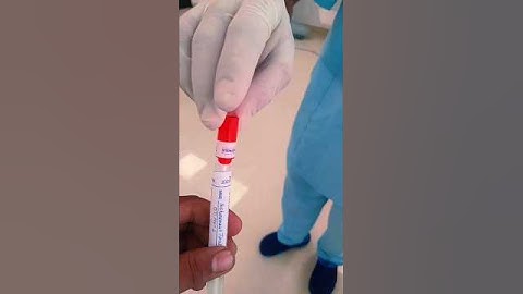 “OT Culture Process | Step by Step Sterility Test in Operation Theatre | OT Technician Training”#ot