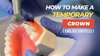 How to Create a Beautiful Temporary Crown