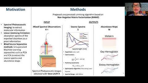 Automatic Unmixing Approach to Detect Tissue Chromophores from Multispectral Photoacoustic Imaging