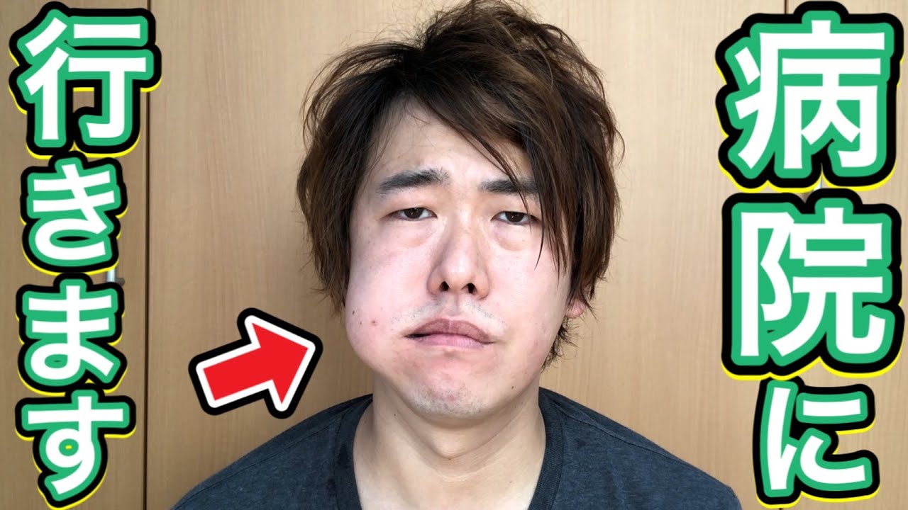 ガチやばい 顔の腫れがひどいので病院に行くことにしました 原因がやばすぎた Anime Wacoca Japan People Life Style