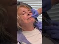 Dr. T Busts Common Lip Filler Myths