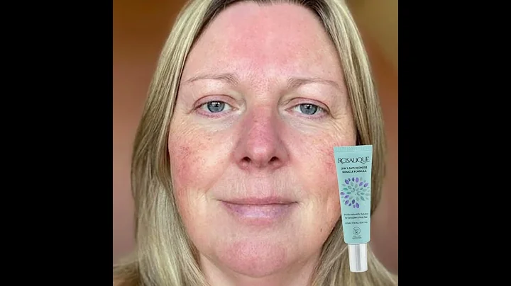 Recensione #4 crema anti rossore ROSALIQUE - GAIL ...