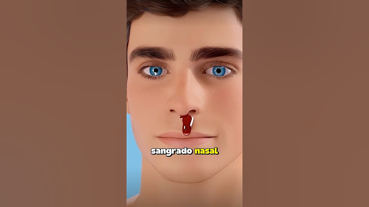 Como parar un sangrado nasal 🩸