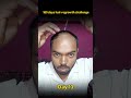 Day 13 | 180 days hair regrowth challenge #hairfallsolution #lifeisbutadream