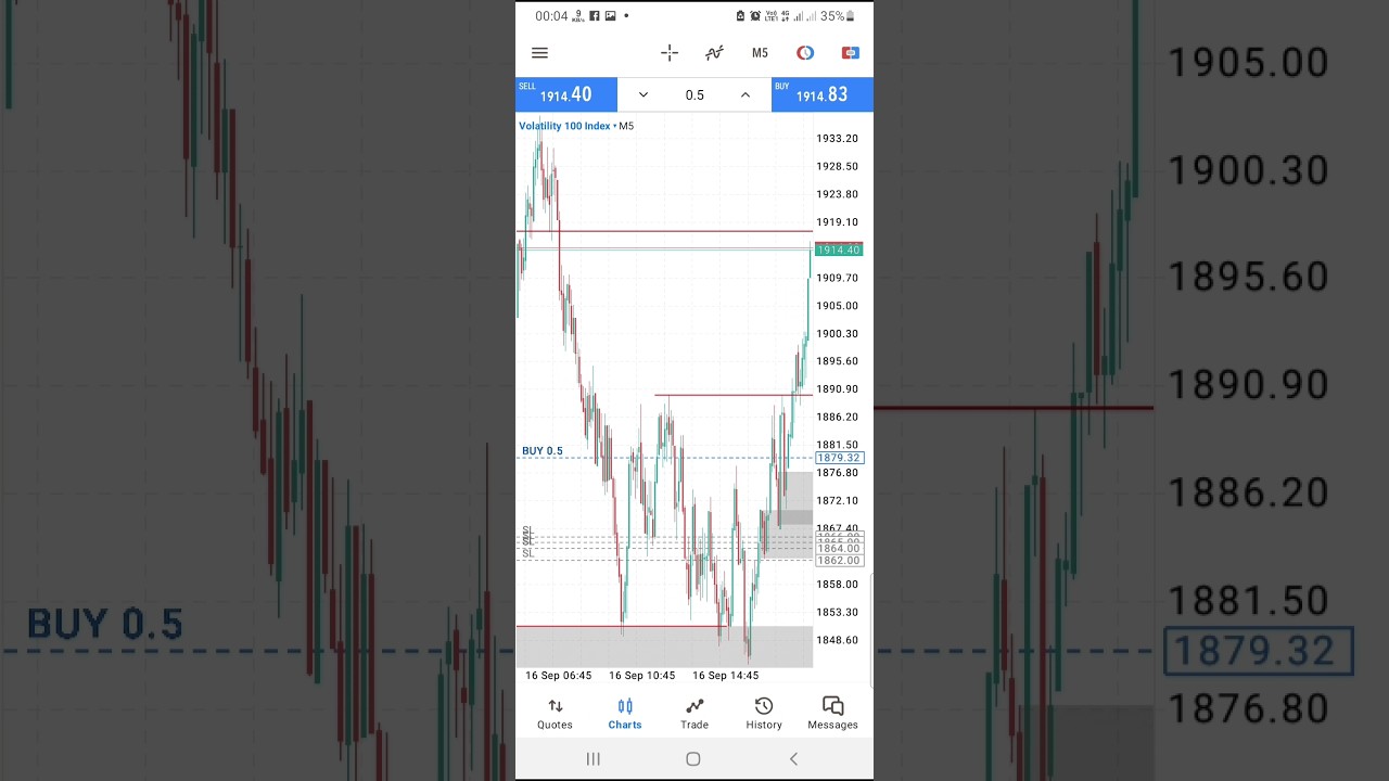 Vix 100 trade (50usd to 200usd) 