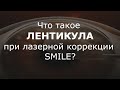 Лентикула в офтальмологии -  что это такое и как происходит её экстракция?