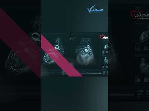 7 أعراض تدل على ضعف عضلة القلب