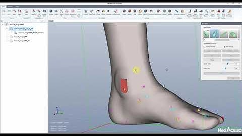 The entire design process of a Hinged AFO with MediACE3D.