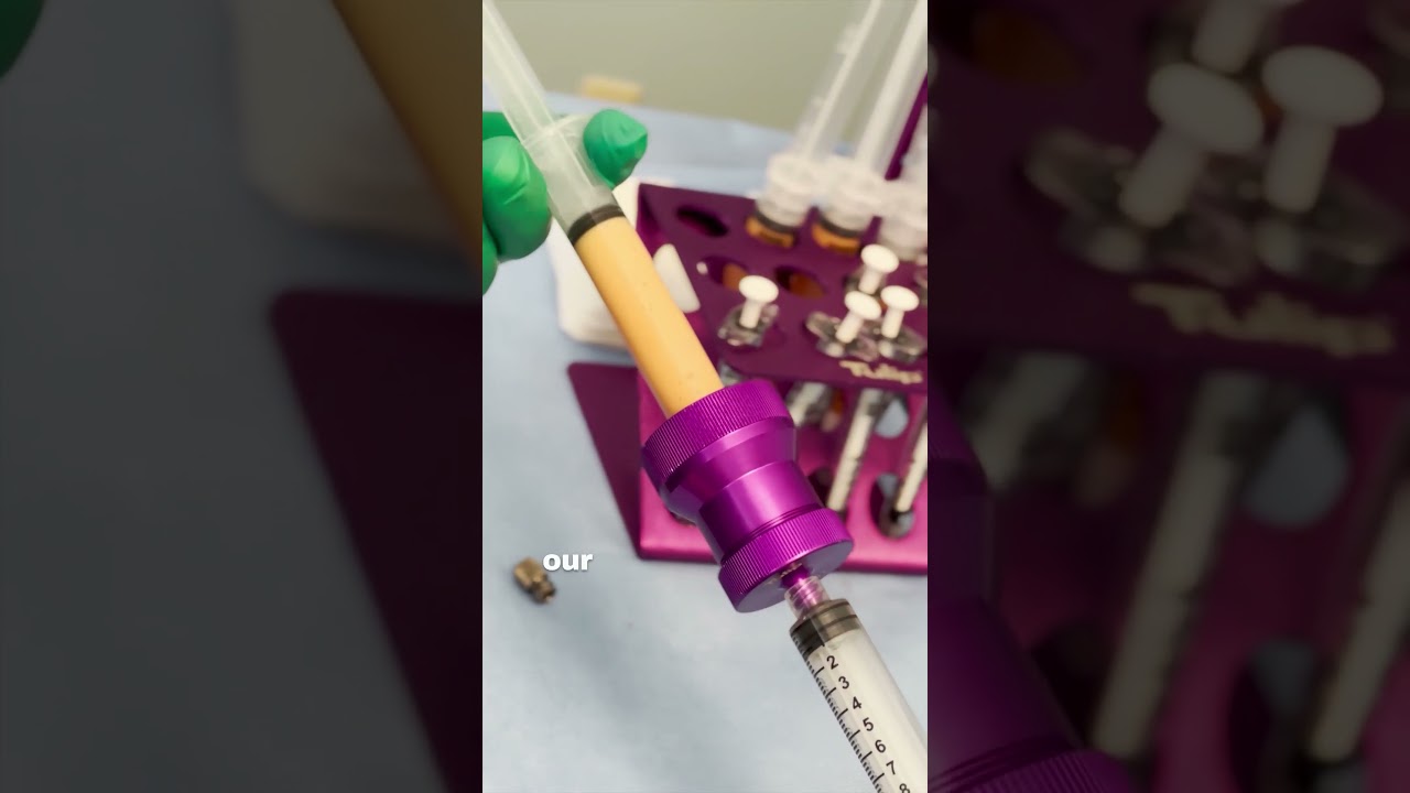 How is Nanofat Filtered? 