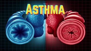 Asthma (update 2019) - CRASH! Medical Review Series