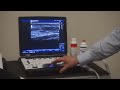 Diagnostic Ultrasound Cheltenham | Find out what is causing your pain | Skelian Chiropractic Clinic