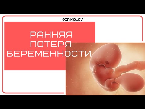 Неразвивающаяся беременность, ранняя потеря беременности на УЗИ