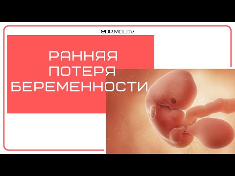 Видео: Что такое нежизнеспособная беременность?