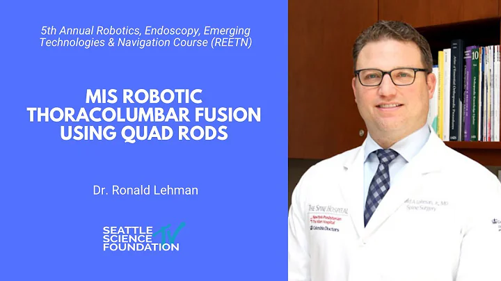 MIS Robotic Thoracolumbar Fusion Using Quad Rods -...