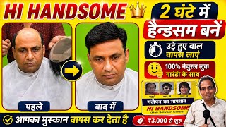 2 घंटे में गंजे से हैंडसम! उड़े हुए बाल वापस,Hair Patch Transformation देखकर चौंक जाएंगे