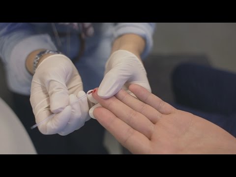 Video: HIV Och Naglar: Symtom, Förändringar Och Mer