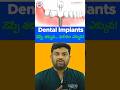డెంటల్ ఇంప్లాంట్ వేస్తే నొప్పి ఉంటుందా? నిజం చెప్పిన డాక్టర్ || Eledent Dental Hospitals || HYD