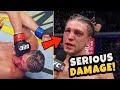 Brian Ortega takes SERIOUS DAMAGE - Doctor Explains Injury Concerns from UFC 266 Fight of the Year