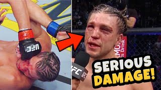 Brian Ortega takes SERIOUS DAMAGE - Doctor Explains Injury Concerns from UFC 266 Fight of the Year
