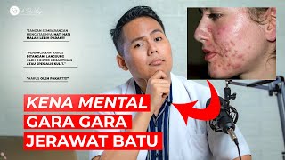 TERKUAK! 5 Penyebab Kulit Gampang Berjerawat dan Cara Mengatasinya | lifestyleOne