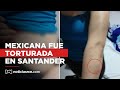 Mexicana sobrevivió a meses de abuso sexual y torturas de su novio en Santander