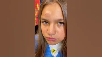 У меня на лбу теперь гигантская шишка 😭 На сотрясение ещё не проверили