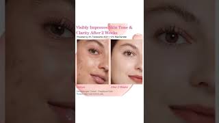 ✨ Dark Spots Gone? Try 10% Niacinamide + 4% Tranexamic Acid Serum 🇸🇦