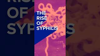 What's Behind the Rise of Syphilis?