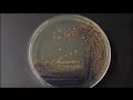 Colors - Bacterial Pigments Time-Lapse