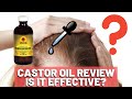 Jamaican Black Castor Oil Review - Is It Effective?