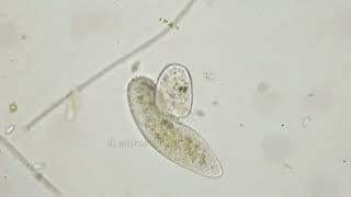 Didinium hunts Paramecium/ Инфузория пожирает туфельку😱