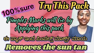 100% Apply This Face Pack Pimples marks will go ಈ ಪ್ಯಾಕ್ ಇಂದ ಪಿಂಪ್ಲೆ ಮಾರ್ಕ್ಸ್, ಸುನ್ ಟನ್ ಮಾಯ ಕನ್ನಡ