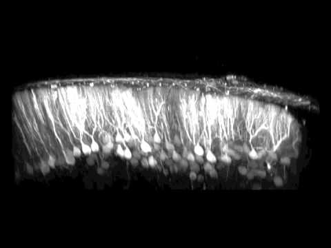 Video: Mohou se Purkyňovy buňky regenerovat?
