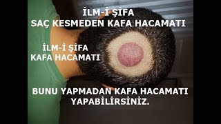 Kafa Hacamatı Nasıl Yapılır ? Saç Kesmeye Gerek Var Mı? Saç Kesmeden Kafa Hacamatı Yapma Yöntemleri Resimi