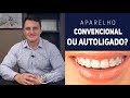 APARELHO AUTOLIGADO / AUTOLIGÁVEL X CONVENCIONAL | WERNER OCKNER