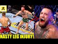 MMA Community Reacts to Conor McGregor snapping his leg and losing to Dustin Poirier,UFC 264 Results