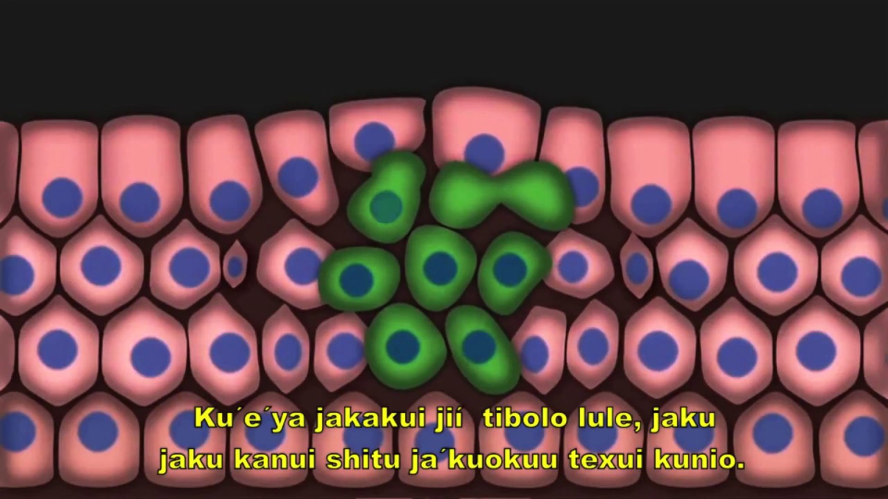 defensa y justicia Detección y atención oportuna de cáncer en las mujeres | Subtítulado en mixteco